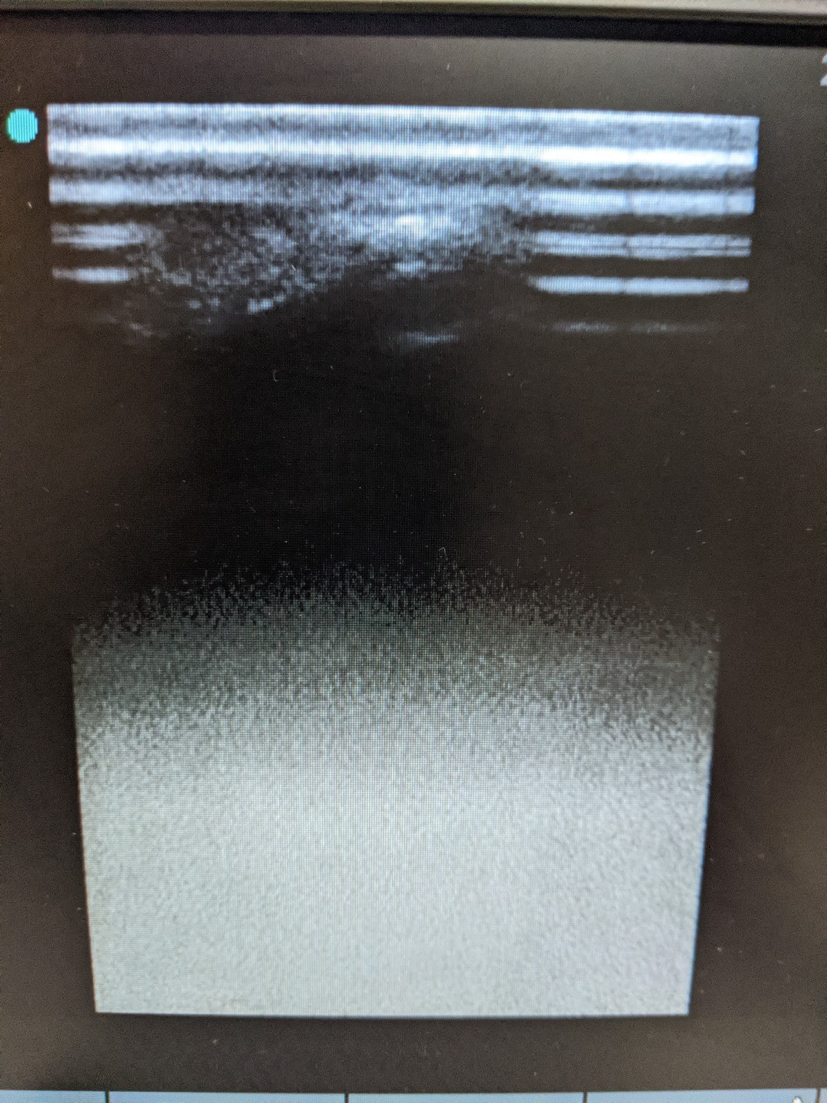 SonoSite S-Cath P08778 Ultrasound System with Probe | MFG 2013