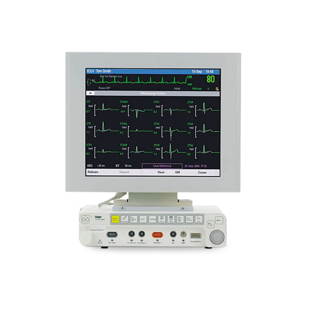 Anesthesia and Co2 Monitors