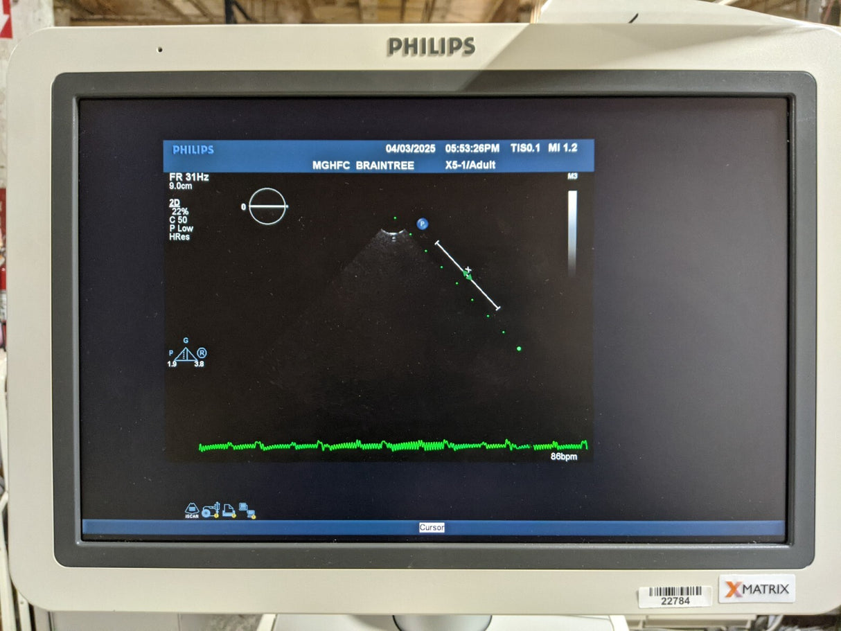 Philips iE33 G-Cart Ultrasound System with 10 Probes