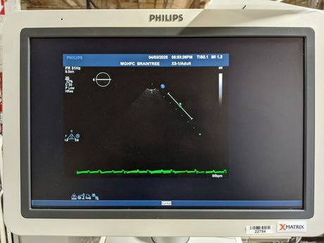 Philips iE33 G-Cart Ultrasound System with 10 Probes