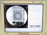 Hologic Fluoroscan InSight 2 | SW 3.1.2 | MFG 2008