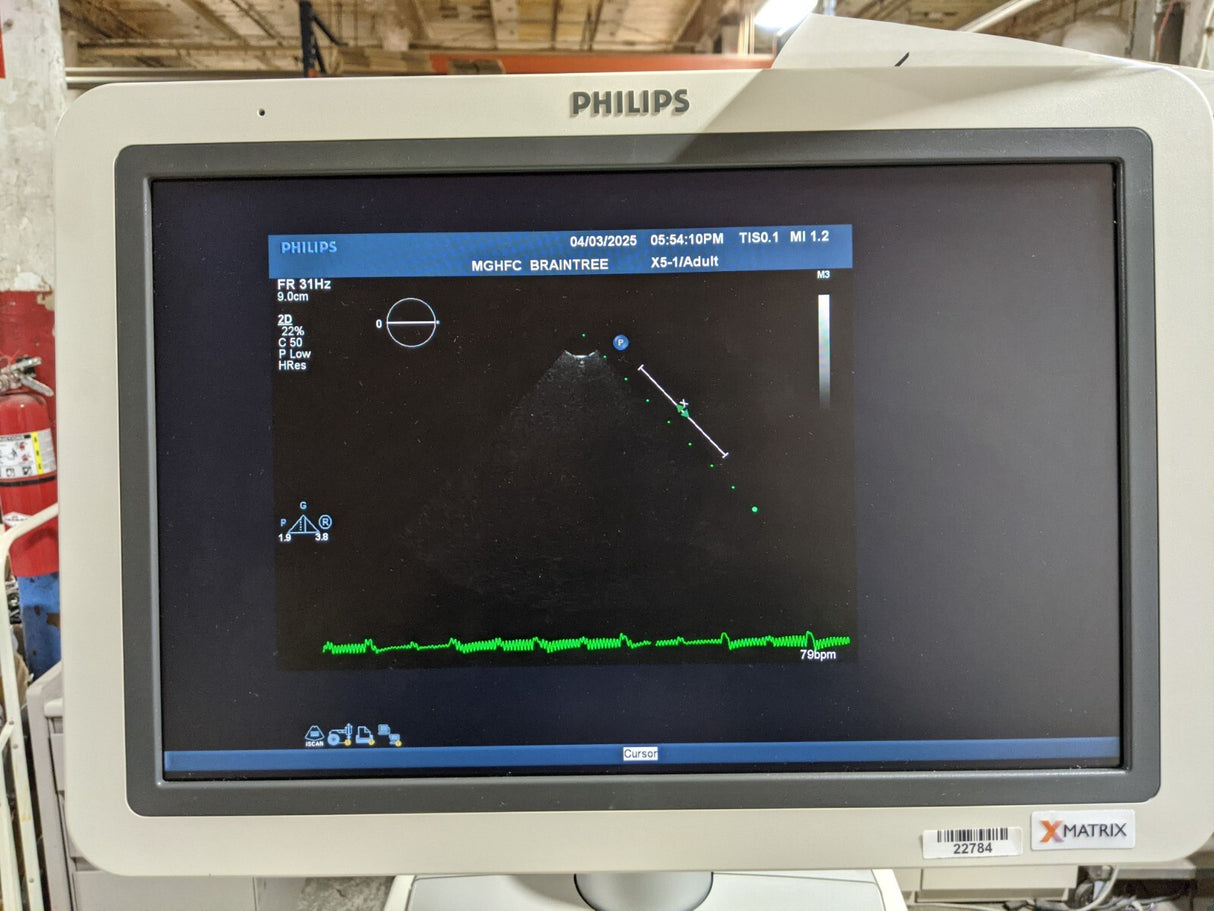 Philips iE33 G-Cart Ultrasound System with 10 Probes