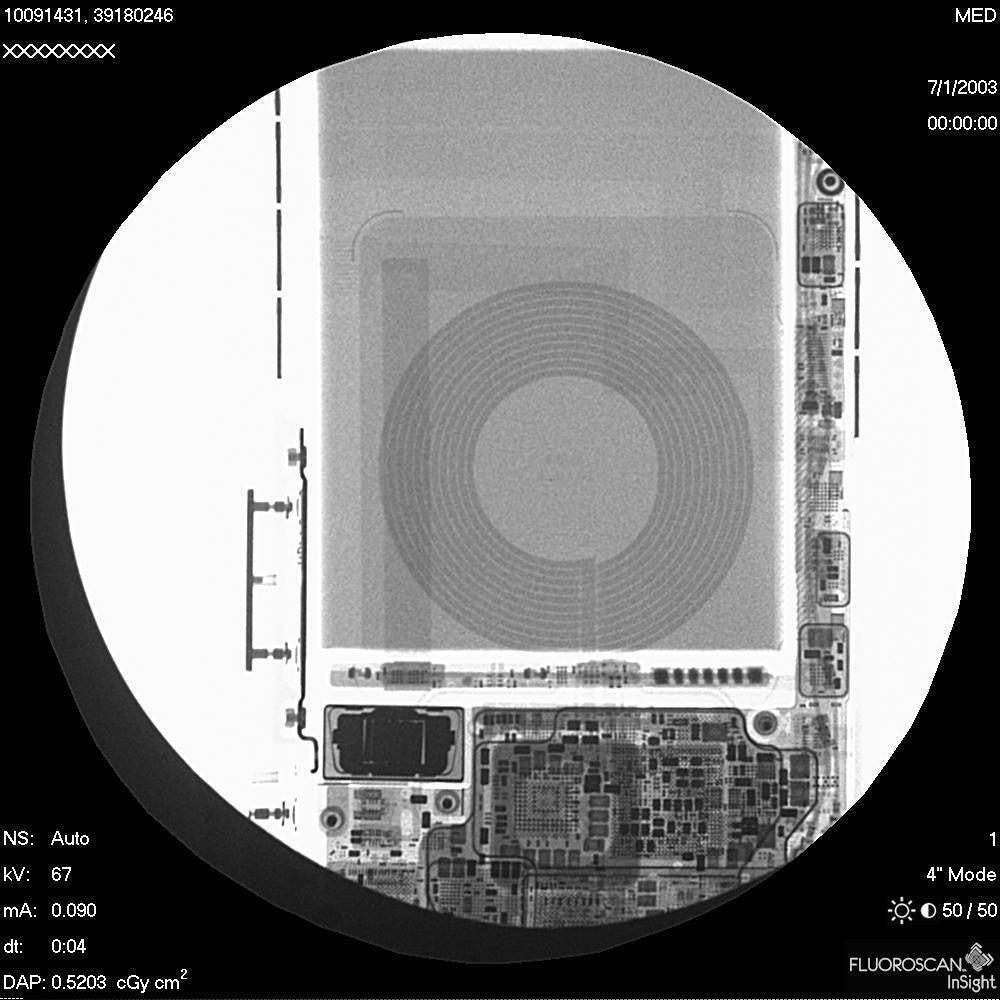 Hologic Fluoroscan InSight 2 | SW 3.1.2 | MFG 2008