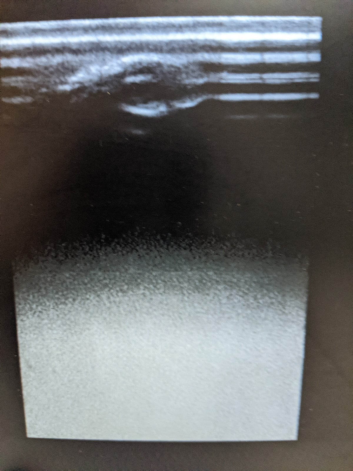 SonoSite S-Cath P08778 Ultrasound System with Probe | MFG 2013