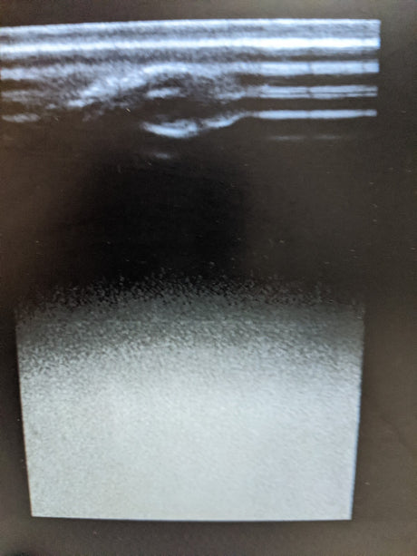 SonoSite S-Cath P08778 Ultrasound System with Probe | MFG 2013
