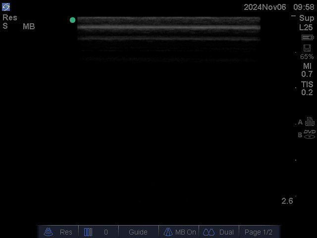 SonoSite L25x/13-6 MHz Transducer P07691-71A Ultrasound Probe | MFG 2018