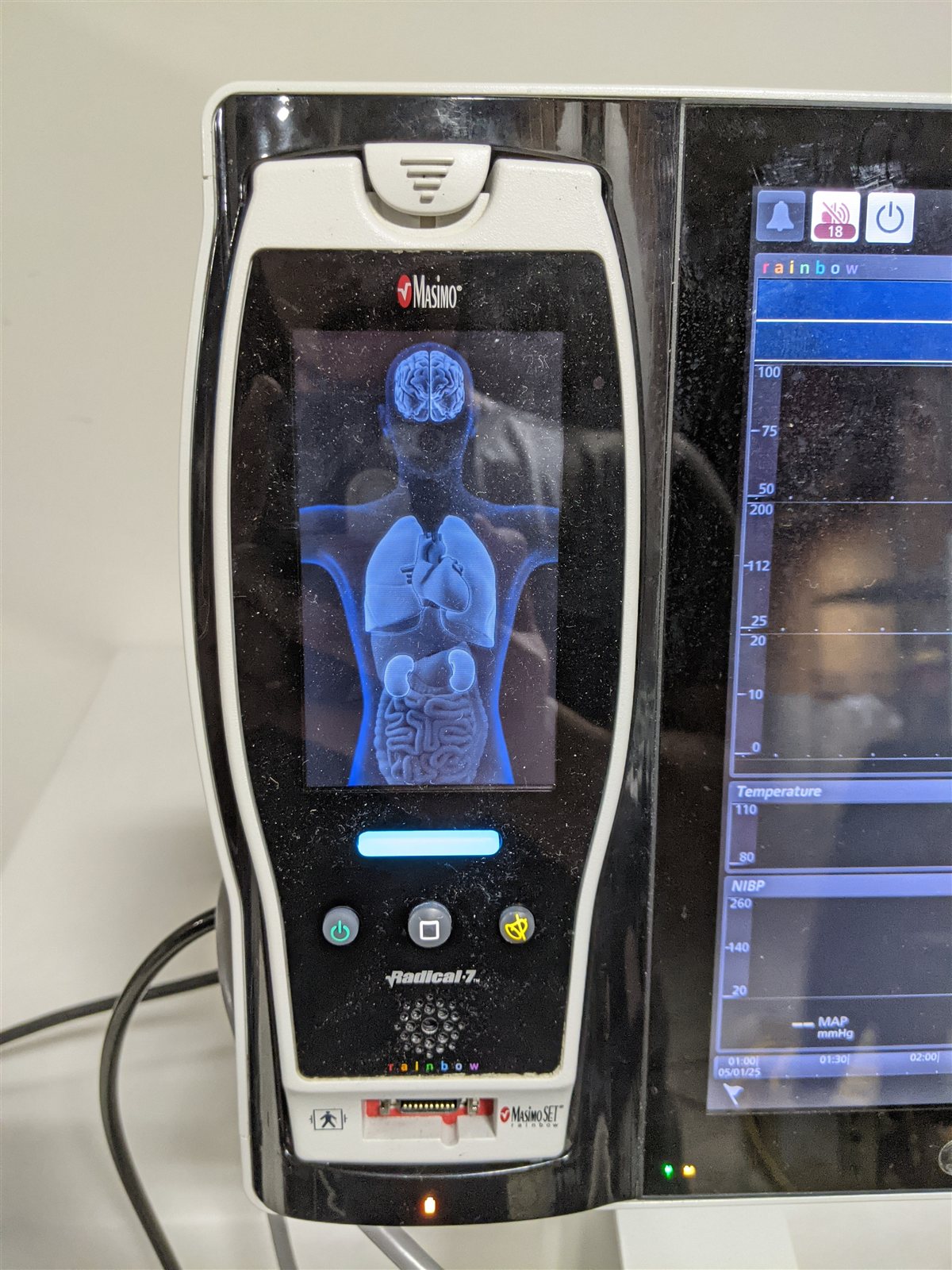 Masimo Root RDS7A with Radical 7 Patient Monitor | MFG 2018
