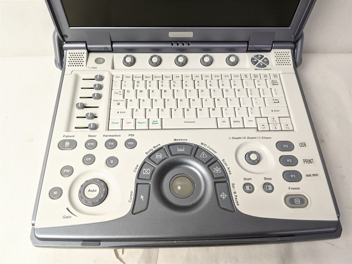 GE Logiq e 5148751 Portable Ultrasound Laptop | MFG 2007